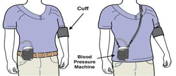 https://www.northwestcpap.com/wp-content/uploads/ABPM.png